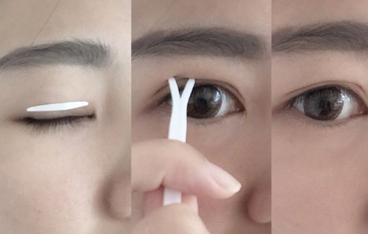寧波除皺紋針醫(yī)生