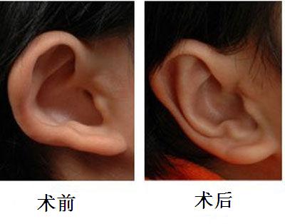 杭州口腔疾病治療首選！濃縮優(yōu)質、平價口腔醫(yī)院一站攻略