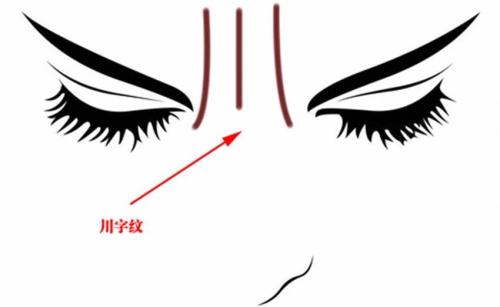 成都雙眼皮修復(fù)手術(shù)：五家性價(jià)比高、技術(shù)好的醫(yī)院推薦