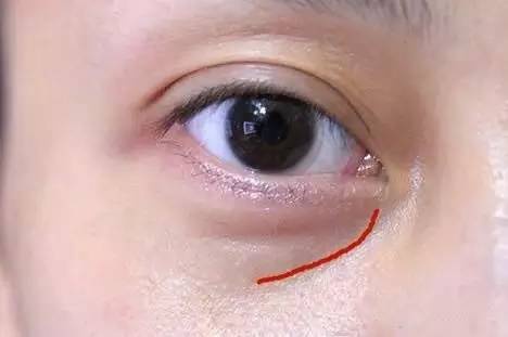 沈陽哪家醫(yī)院做雙眼皮好？推薦這幾家，讓你的雙眼美麗動人起來！