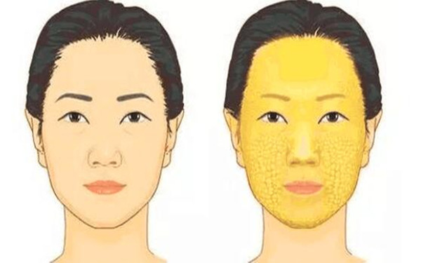 滄州治療疤痕的正規(guī)醫(yī)院推薦：專業(yè)科技祛疤，效果顯著！點(diǎn)擊了解！