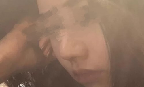 海南哪家醫(yī)院做隆鼻效果好