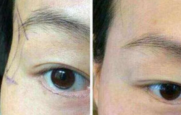 江蘇區(qū)整容醫(yī)院推薦：想在江蘇改頭換面的友人來(lái)看看這篇！高質(zhì)量美容機(jī)構(gòu)盤點(diǎn)提供參考