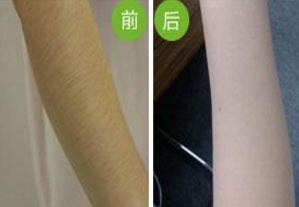 武漢頂尖整形醫(yī)院盤點(diǎn)：協(xié)和、美立方、壹加壹等脫穎而出！是否心儀醫(yī)院榜上有名？速來一探究竟！