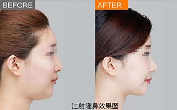 鄭州唇部整形醫(yī)院推薦：如何選擇合適的醫(yī)院？友友必看！