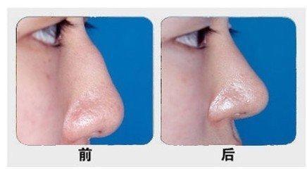 石家莊主要公立整形醫(yī)院排行榜！公辦醫(yī)療機構(gòu)最具實力！