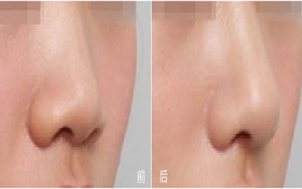 福建五所知名整形醫(yī)院盛世薈萃：瑞麗、愛思特、雅美等品牌強(qiáng)勢(shì)入圍！