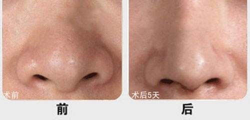廈門市有哪些醫(yī)院提供優(yōu)質(zhì)的脂肪填充服務？江頭醫(yī)院、臉康整形醫(yī)院、美麗醫(yī)療中心等值得一看！快來了解一下