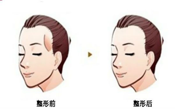 西寧顴骨矯正術(shù)：哪家醫(yī)院口碑好？2023年口碑排名前10的正規(guī)醫(yī)療整形醫(yī)院公布！
