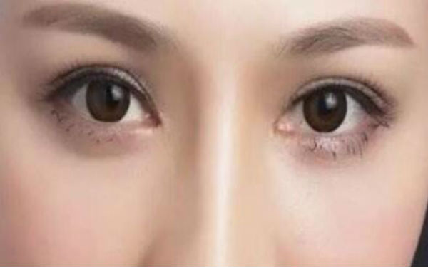 2023年選擇好的常德三點(diǎn)雙眼皮醫(yī)院，整形效果有哪些？排名前十強(qiáng)醫(yī)院值得信賴！