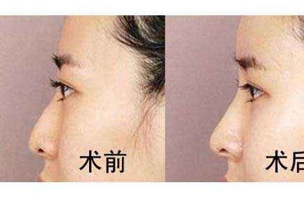 六安市受歡迎的雙眼皮整形美容醫(yī)院排行榜出爐！2023最值得信賴的明眸翹睫醫(yī)療機(jī)構(gòu)盤點(diǎn)！