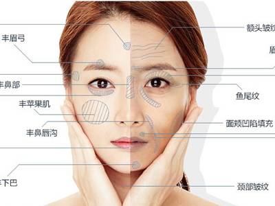 廣州臉部打溶脂針排名前10的美容醫(yī)院口碑大揭秘！2023年很受好評(píng)的整形醫(yī)院技術(shù)盤(pán)點(diǎn)！