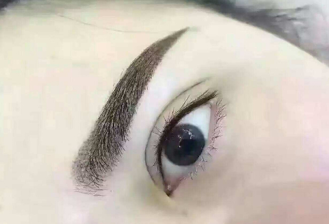 鄭州眉間紋淡化，2023年十大整形美容醫(yī)院推薦