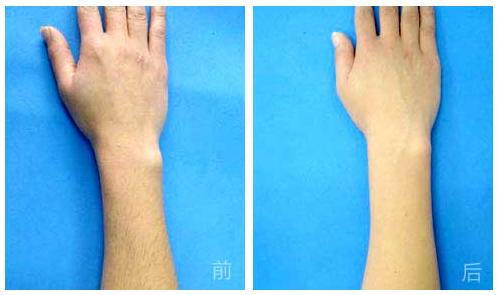 杭州哪家整形美容醫(yī)院能有效避免眼部皺紋？2023年杭州眼部皺紋美容醫(yī)院前十位排行榜來啦！