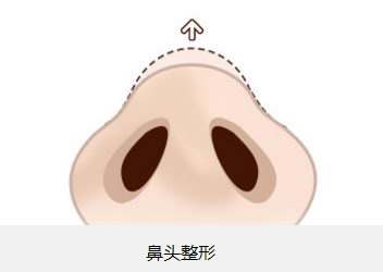 2023廈門注射豐耳垂術美容醫(yī)院前10強榜盤點，哪家口碑比較好？