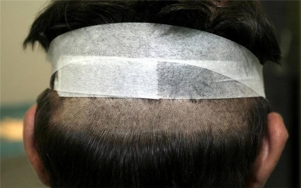 重慶哪家醫(yī)院豐唇口碑好？2023年榜單前十大整形美容醫(yī)院推薦！