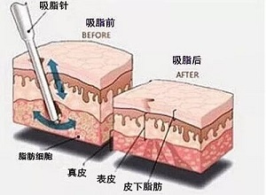 2023蕪湖鼻梁骨矯正醫(yī)院久負(fù)盛名，口碑贊譽(yù)不絕于耳！