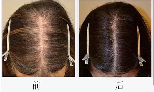 廣州哪些醫(yī)院可靠，專業(yè)進(jìn)行臉部疤痕切除整形美容？2023年十大排名公開！