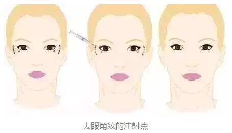 2023年北京鼻端缺損整形美容醫(yī)院前十強(qiáng)排名揭曉！知名度爆棚的醫(yī)療機(jī)構(gòu)盤點(diǎn)！