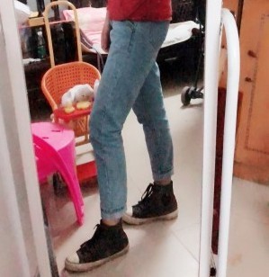 胖腿女孩兒福利分享：吸脂瘦大腿的蛻變，效果值得點贊！