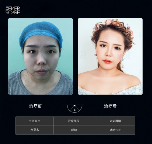 阿爾法9°美眼，打開視界，美無(wú)止境