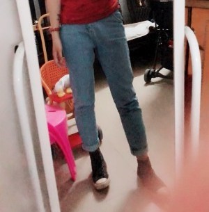 胖腿女孩兒福利分享：吸脂瘦大腿的蛻變，效果值得點贊！