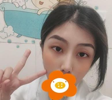 救命，周杰群做的耳軟骨隆鼻恢復(fù)后鼻背線條也太好看了吧