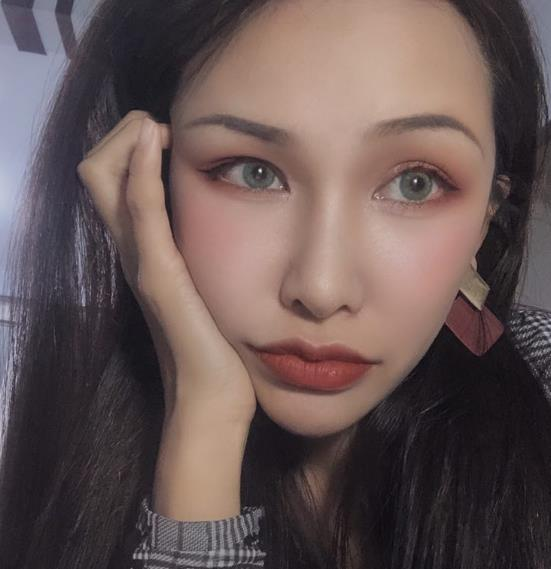 長春中研整形黃帝云鼻頭縮小術(shù)后三個月效果反饋圖