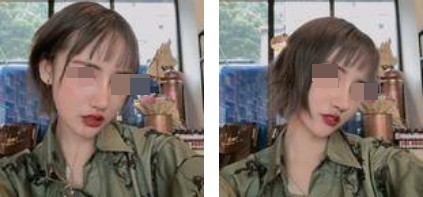 一個鼻子讓一張臉迅速高級，還不考慮做個鼻綜合嗎
