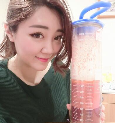 揭陽(yáng)美萊整形手臂吸脂案例分享，輕松告別拜拜肉