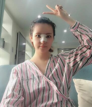 北京葉子整形肋軟骨隆鼻案例反饋，這鼻子是真實(shí)存在的嗎