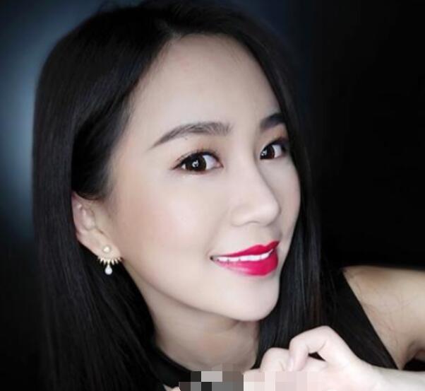 深圳鵬程整形劉冰做的鼻子術后三個月