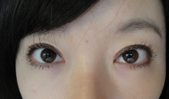 在鄭州望京做全切雙眼皮+開外眼角，術(shù)后效果確實(shí)沒讓我失望