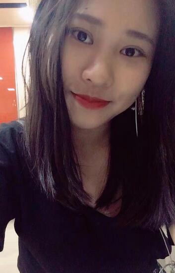 肇慶華美整形切開雙眼皮術(shù)后三個月效果分享，這不比貼雙眼皮香？