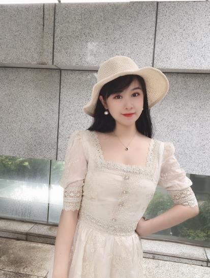 南方醫(yī)院整形美容科顴骨內(nèi)推半年效果反饋，同款集美有救了