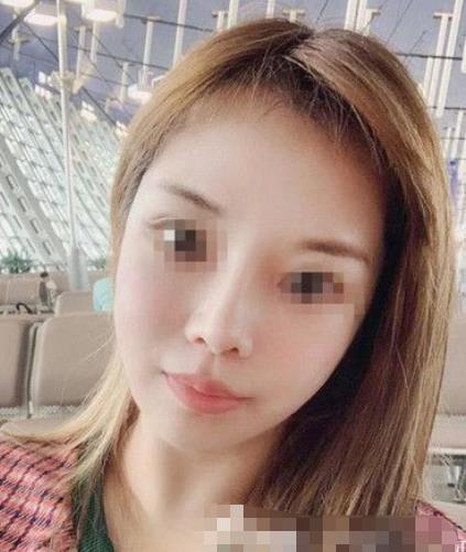 南京閱顏整形瘦臉針注射后半個(gè)月
