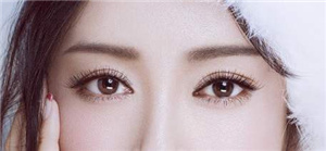 貴陽(yáng)美和諧醫(yī)療美容門診部做雙眼皮術(shù)后效果