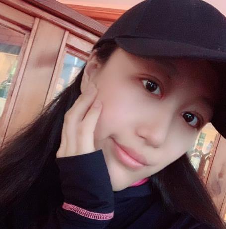 上海華美楊亞益做眼部修復(fù)案例效果對(duì)比圖
