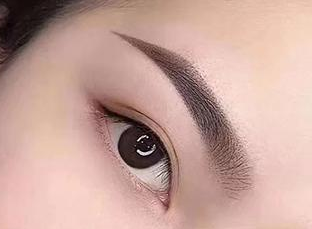 昆山百達麗醫(yī)療美容門診部開內(nèi)眼角術后效果
