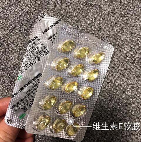 激光點痣之后服用維生素E軟膠囊