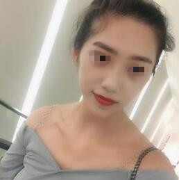 耳軟骨隆鼻中