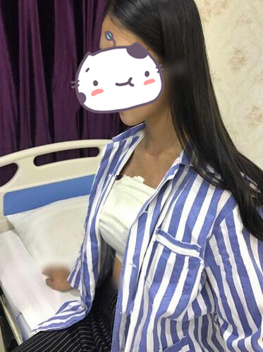 北京冰蝶醫(yī)療整形張克旭琴面假體隆胸案例，隆胸效果對比圖