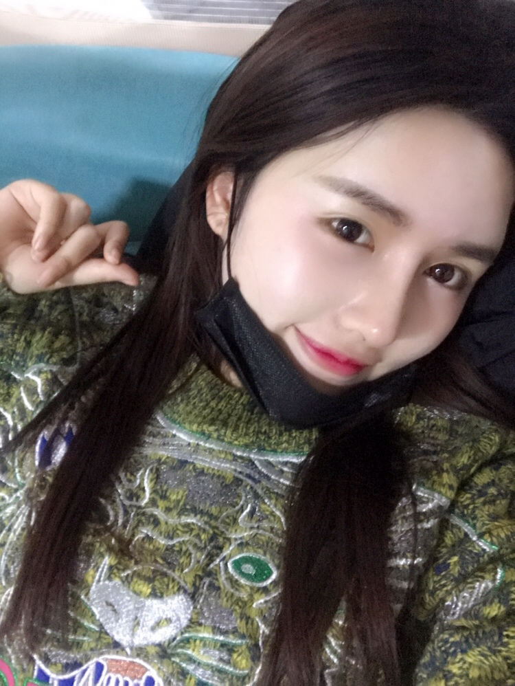 北京星美李寧輝進(jìn)口膨體隆鼻案例效果對比圖，鼻子自然又美麗