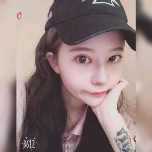 王良發(fā)假體隆鼻案例效果對比圖