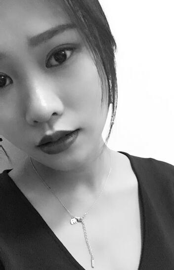 上海伊美爾港華整形醫(yī)生師麗麗做雙眼皮怎么樣？師麗麗雙眼皮案例分享
