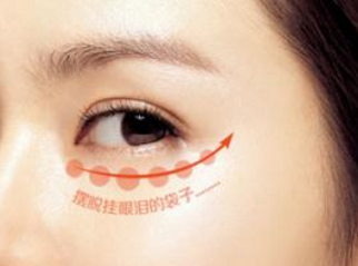 上海新健威醫(yī)療美容門診部激光祛眼袋