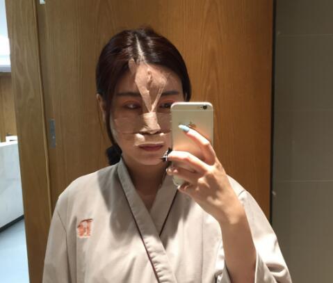 鼻綜合整形手術(shù)時
