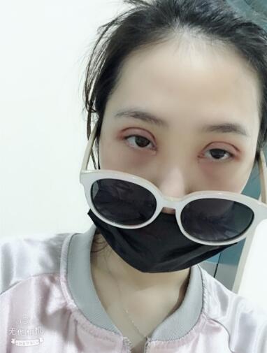 手術(shù)之后