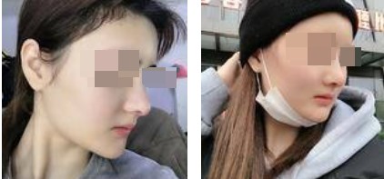 恢復(fù)過程