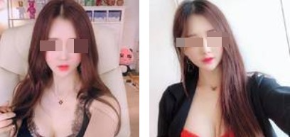 沈陽(yáng)杏林整形美容醫(yī)院崔昌墉醫(yī)生做假體隆胸技術(shù)怎么樣？附案例